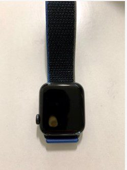 Проблемы с перегревом Apple Watch SE приводят к ожогам запястий и повреждению дисплея