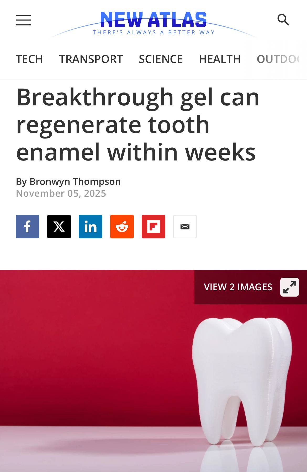 Учёные разработали гель, восстанавливающий зубную эмаль без сверления Учёные разработали гель, восстанавливающий зубную эмаль без сверления